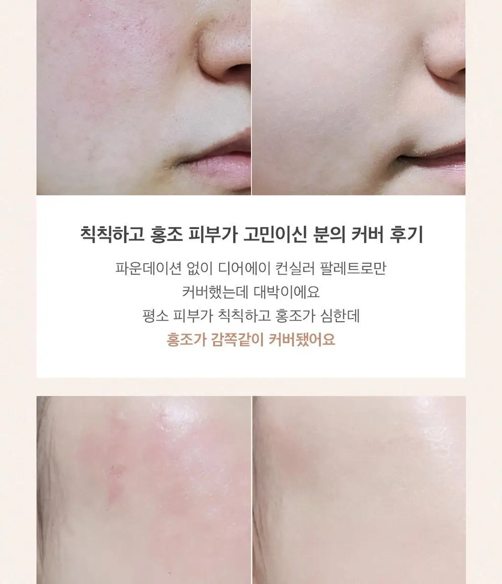 [NEW컬러출시/치크밤 증정 기획] 디어에이 퍼펙트 커버 컨실러 팔레트 기획 5종 상세페이지 10